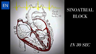 Sinoatrial Block Animation and ECG Shorts [upl. by Silvio200]