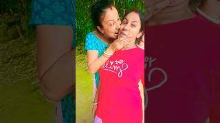 কামড়ে দিল 😲😲 viralshort funnyvideos youtubeshorts entertainmentr trending comedyvideos [upl. by Filmore724]