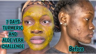 TURMERIC and ALOE VERA for 7 days  how to get rid of dark spots and pigmentation EFFECTIVELY [upl. by Fauman587]