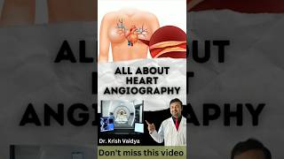 All about heart angiography heart heartattack hearthealth shorts shortfeed drkrishvaidya [upl. by Frederigo]