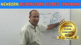 Newborn Respiratory Distress Syndrome  Pathophysiology🫁 [upl. by Haibot]