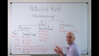 Petechial Rash  Approach [upl. by Iloj731]