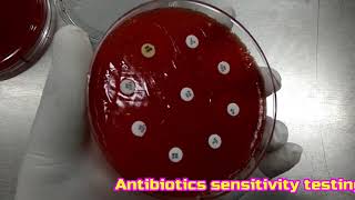 An unusual Streptococcus from human urine Streptococcus urinalis isolation [upl. by Ehrsam]