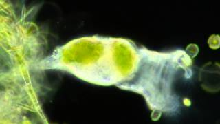 Rotifers Feeding [upl. by Gnilhsa650]