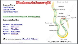 Wuchereria Filarial Worm [upl. by Henricks]