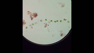 Microspora cells becoming flagellated Zoospores  5x speed [upl. by Sucramat]