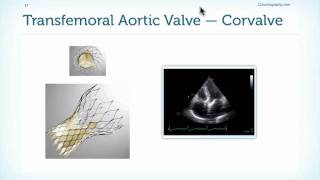 Assessment of Prostheses in Echocardiography [upl. by Nosral573]