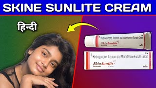 Skine Sunlite Cream Review in Hindi  by Mt discuss [upl. by Wilkens]