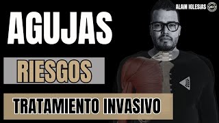 ▪️✅PUNCIÓN SECA ELECTROPUNCION TECNICAS INVASIVAS FACTORES DE RIESGO▪️ [upl. by Nylg]