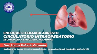 Webinar Enfoque Literario Arresto Circulatorio Intraoperatorio Secundario a Embolismo Pulmonar [upl. by Kaitlin]