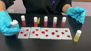 Blood Typing PBL Mahtaab M [upl. by Nallid]