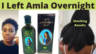 I Used Amla Oil On My Natural Hair Overnight and I Got Shocking Results [upl. by Gianina]