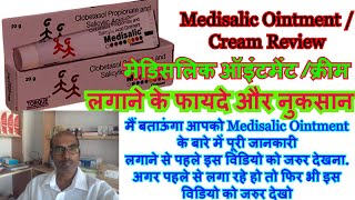 Medisalic Ointment Cream Review Benefits and Side Effects मेडिसलिक ऑइंटमेंट के फायदे और नुकसान [upl. by Trbor]