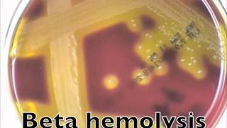 Comparison of hemolysis on blood agarmov [upl. by Romie]