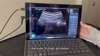 The Use of Ultrasound For Pelvic Floor Therapy [upl. by Niko]