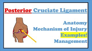 Posterior Cruciate Ligament PCL Tear  Anatomy Features Examples Investigations Management [upl. by Eilyr]