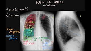 Radio du thorax  Introduction  Partie 1  Docteur Synapse [upl. by Boarer]