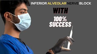 Inferior alveolar nerve block in every case [upl. by Neehsar]