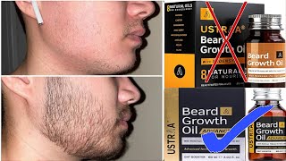 how to use best beard oil for beard growth [upl. by Torrell]