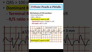 ECG Changes of TCA Overdose doctor medical nursing [upl. by Wilhelmine305]