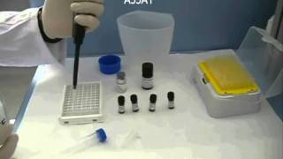 Phosphatase assay Microcystest [upl. by Cleo968]