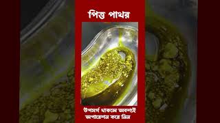 gallstones gallstonessymptoms পিত্তথলিরপাথর [upl. by Fanya]