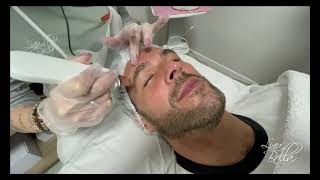 OXIGENOTERAPIA TRATAMIENTO FACIAL [upl. by Tnerual]