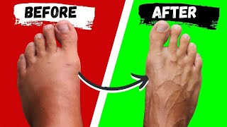 How To Shrink Swollen Ankles To Look Skinny Again [upl. by Wendie]