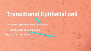 Epithelial cell types and its identification [upl. by Gonyea]