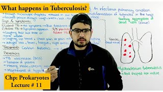 Tuberculosis TB  Causes Treatment Prevention and Transmission [upl. by Ahsilif300]