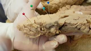 NEUROANATOMÍA CEREBROcorte sagital configuración internaMorfofisiología 2018I [upl. by Adon]