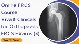 Online FRCS Course  Viva amp Clinicals for Orthopaedic FRCS Exams 4 wwwOrthopaedicAcademycouk [upl. by Anayra290]