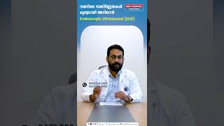 വയറിലെ സങ്കീർണ്ണതകൾ കൃത്യമായി അറിയാൻ Endoscopic Ultrasound EUS  Dr Anup S Nair [upl. by Ayila]