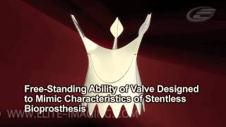 Heart Valve Manufacturing Process  Medical amp Scientific Video Production [upl. by Nwahsid]