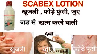 Scabex Lotion Full Information and Preview  शरीर में खुजलीफोडे फुंसीजुए मिटाने की सबसे अच्छी दवा [upl. by Enileve385]