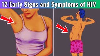 12 Warning Signs of HIV  HIV Symptoms in Men  HIV Symptoms in Women  HIV AIDS [upl. by Ajaj]