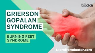 Grierson Gopalan syndrome  Burning Feet Syndrome  Explained [upl. by Marquet234]