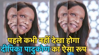 Chhapaak  Chhapaak Movie first look  Deepika Padukone to Play Acid Attack Survivor Laxmi Agarwal [upl. by Nomzed470]