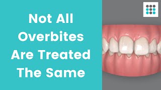 NOT ALL OVERBITES ARE TREATED THE SAME l Dr Melissa Bailey Orthodontist [upl. by Xilef]