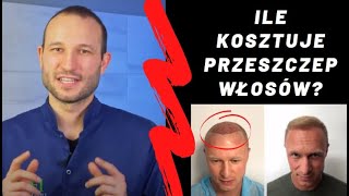 Ile kosztuje przeszczep włosów Dlaczego skąpy dwa razy traci Cena przeszczepu włosów [upl. by Nerw]