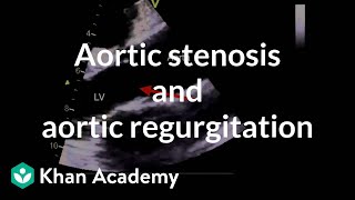 Aortic stenosis and aortic regurgitation  Circulatory System and Disease  NCLEXRN  Khan Academy [upl. by Renato]