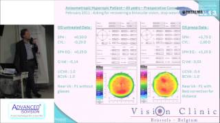 Dr Thierry VANDORSELAER  Les traitements Hypermétropiques donnent une bonne NV et DV [upl. by Arraes883]