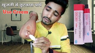 खुजली दिनाव को जड़ से मिटाने की दवा। How To use Derobin Creem Fungal Infection [upl. by Ahseen810]