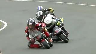 The Minibike Crash that Made a 10 Year Old World Famous [upl. by Andromeda142]