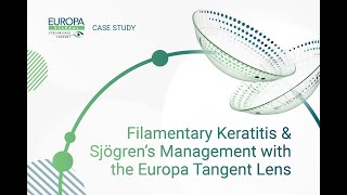 Filamentary Keratitis amp Sjögren’s Management with the Europa Tangent Lens [upl. by Akehsar10]