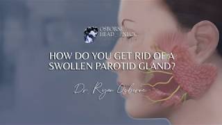 How do you get rid of a swollen parotid gland [upl. by Deane]