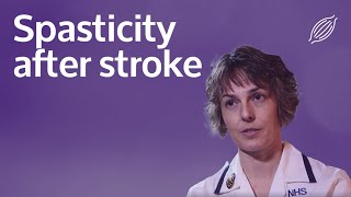 Spasticity after stroke [upl. by Veronike]