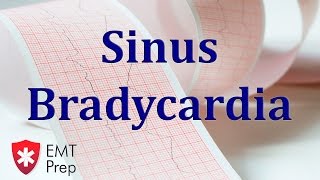 Sinus Bradycardia ECG  EMTprepcom [upl. by Einahpetse]