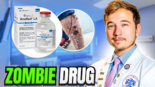 Flesh Eating Zombie Drug Spreading Across the US  Doctor Explains [upl. by Einnig]