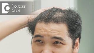 How to treat hair thinning in front part of the scalp  Dr Nischal K [upl. by Gwenn]